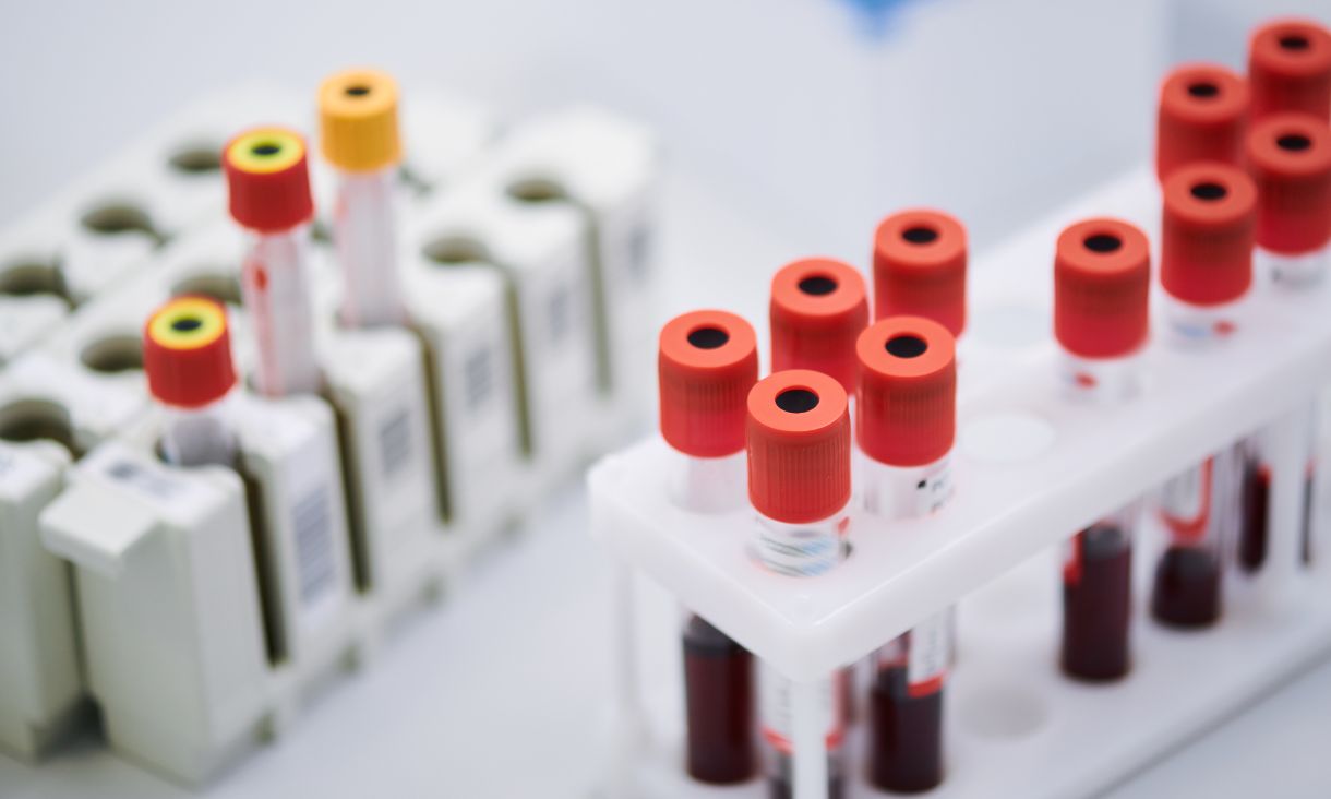 Test tubes containing blood samples